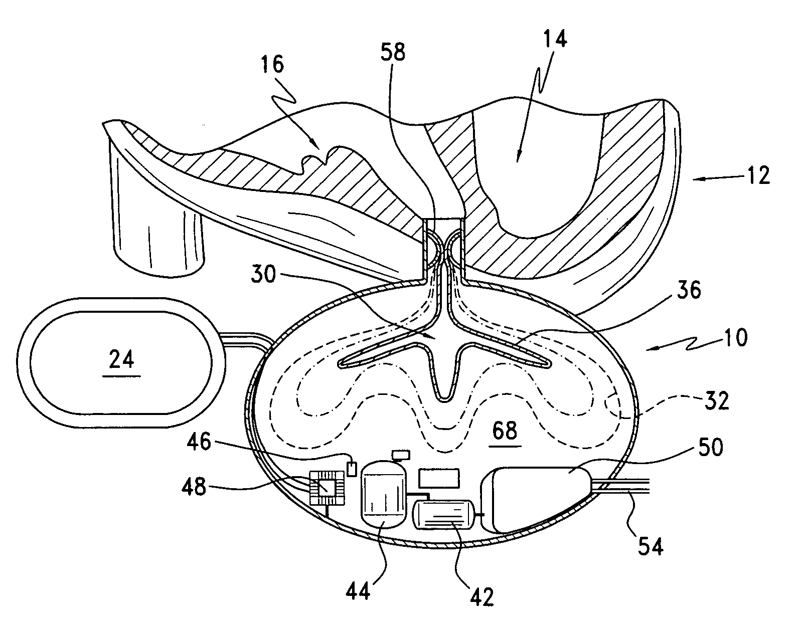 Nondestructive fluid transfer device