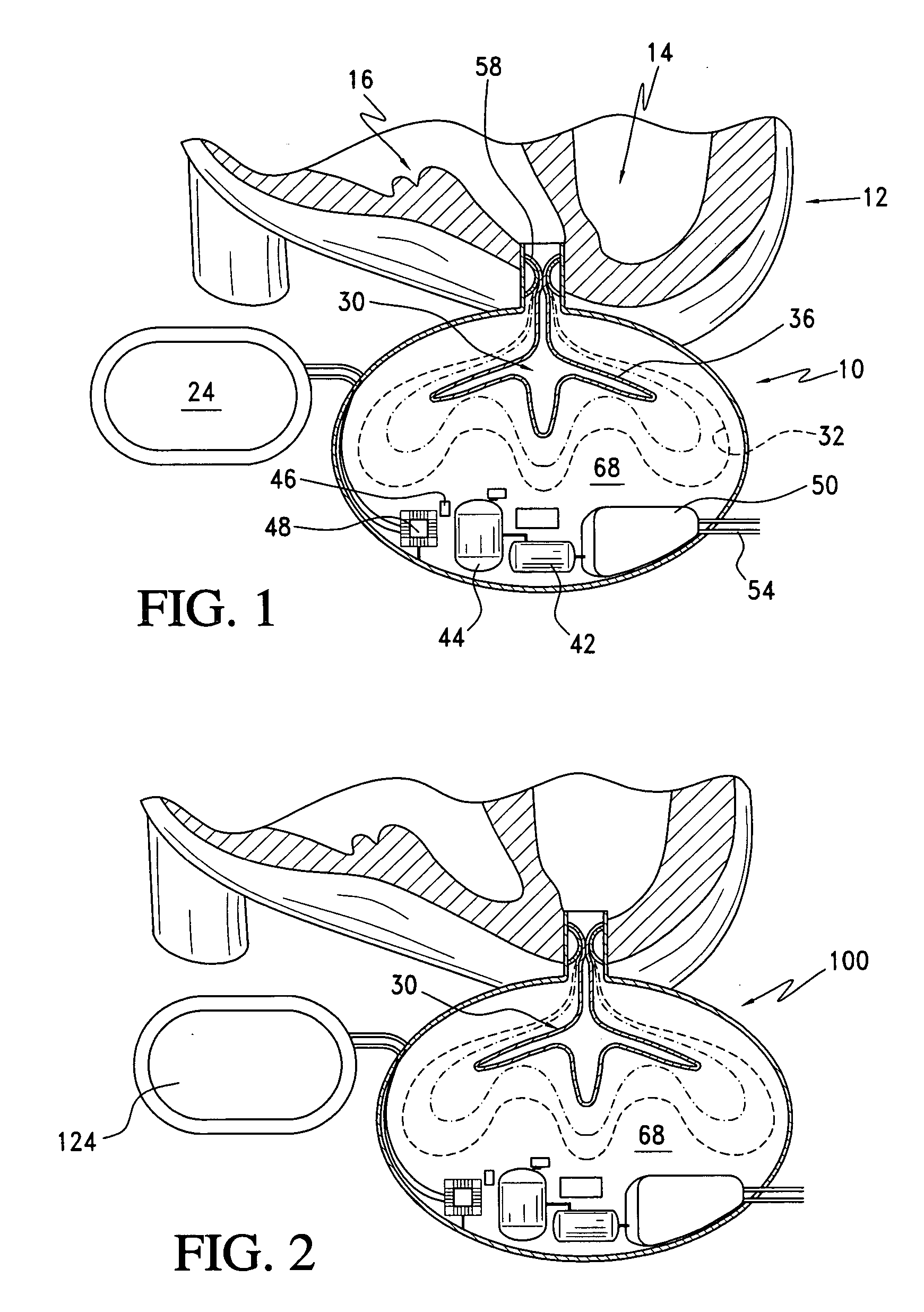 Nondestructive fluid transfer device