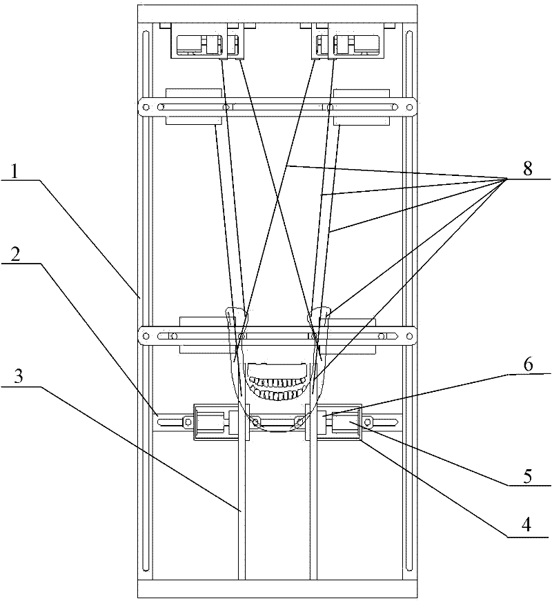 Wire-driven redundant parallel masticatory robot