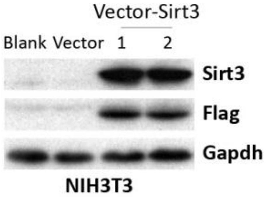 Application of autophagy-deacetylase SIRT3 regulation axis in blood anti-aging