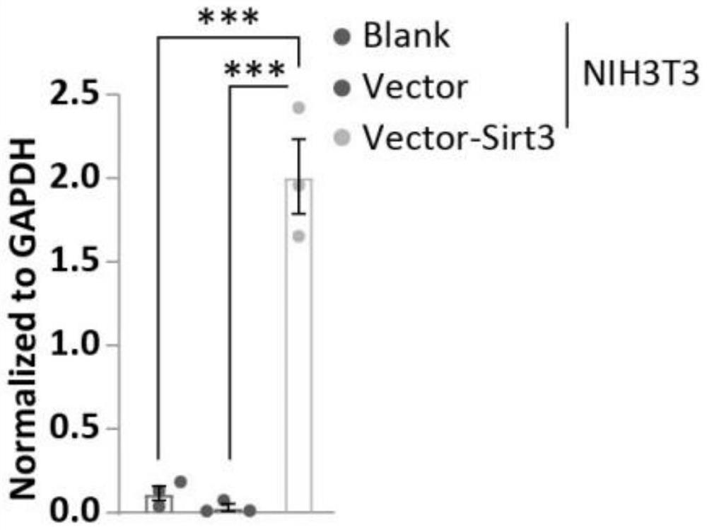 Application of autophagy-deacetylase SIRT3 regulation axis in blood anti-aging