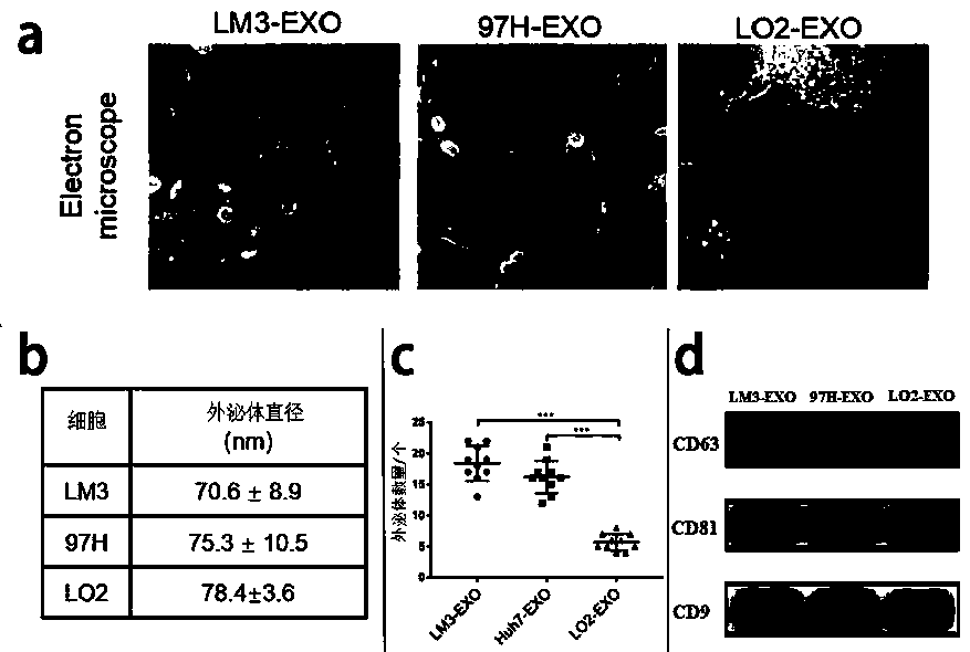 Serum exosome miRNA marker related to liver cancer diagnosis, and application thereof