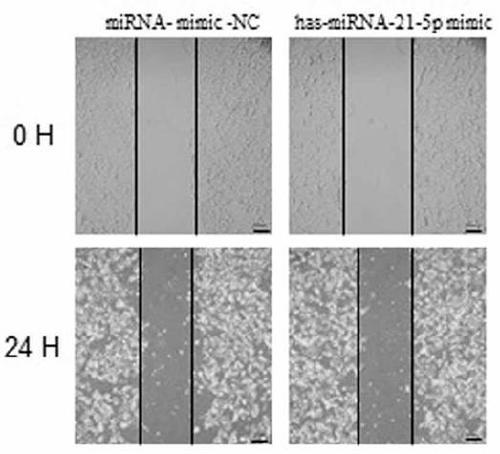 Serum exosome miRNA marker related to liver cancer diagnosis, and application thereof