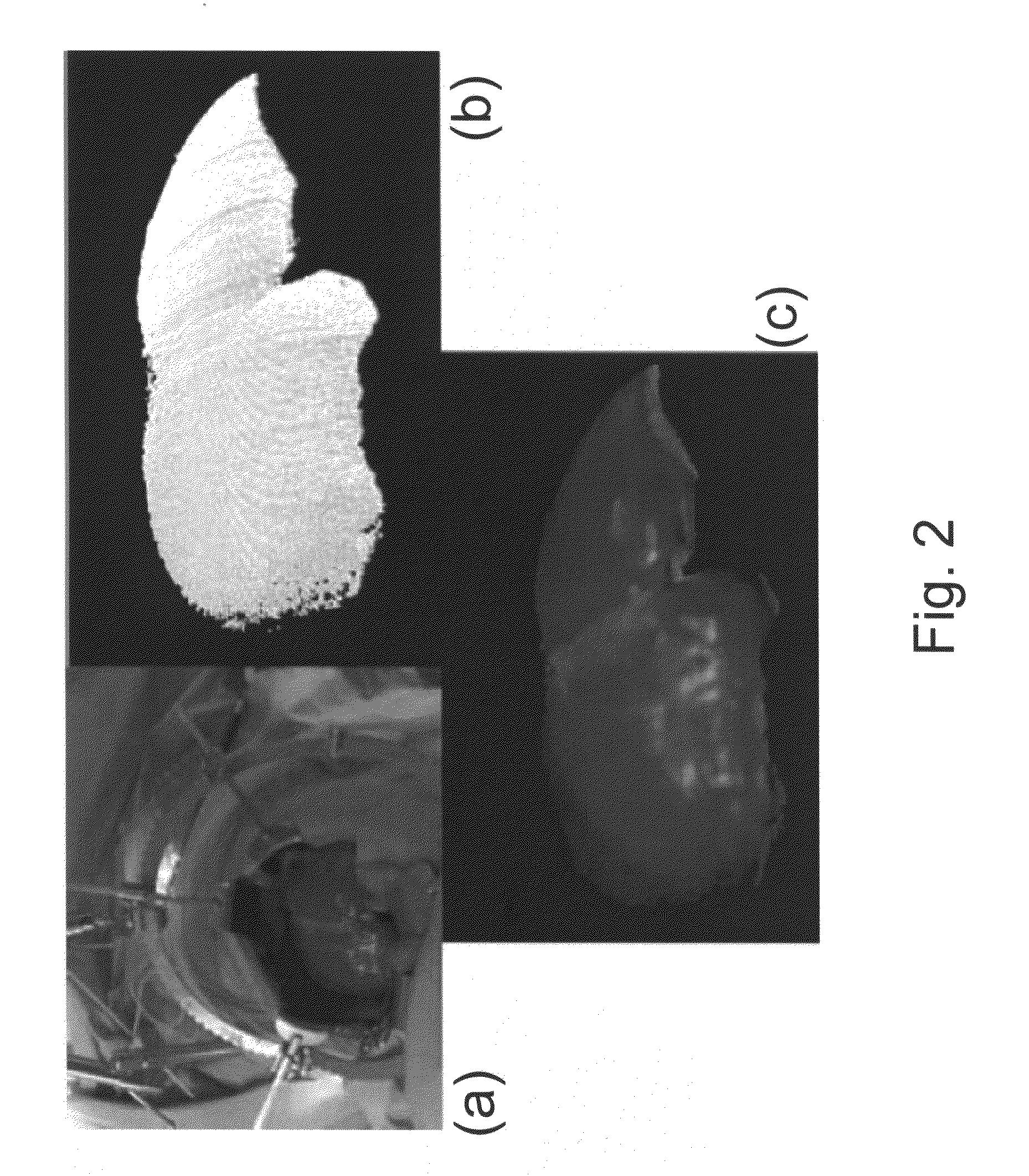 Apparatus and methods of compensating for organ deformation, registration of internal structures to images, and applications of same