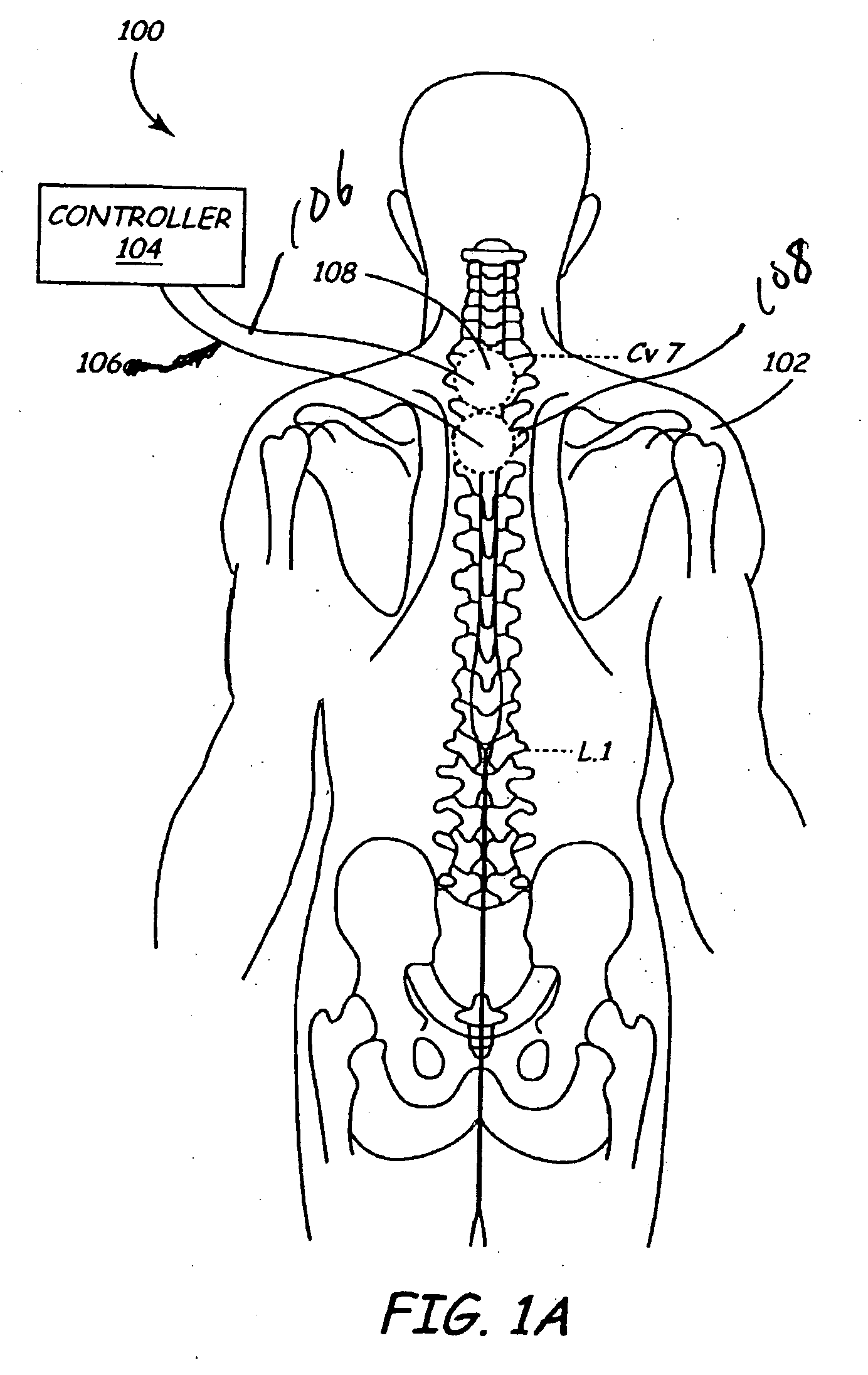Methods and apparatus for sensing cardiac activity via neurological stimulation therapy system or medical electrical lead