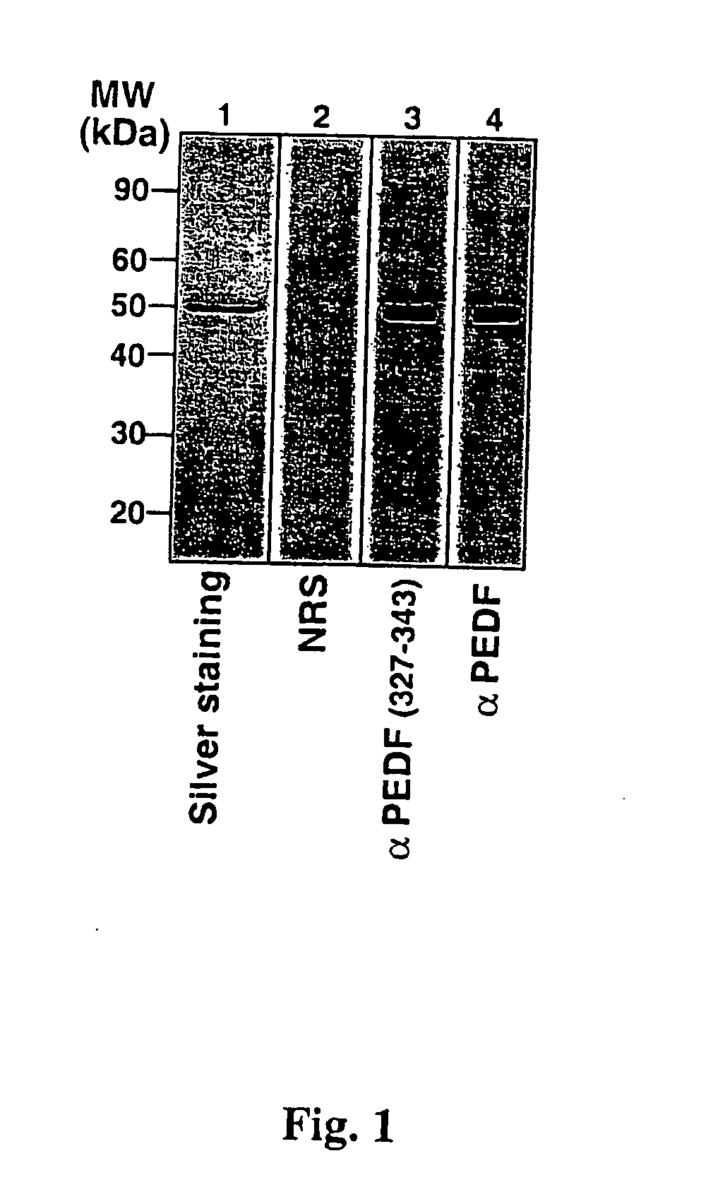 Pigment epithelium derived factor from human plasma and methods of use thereof