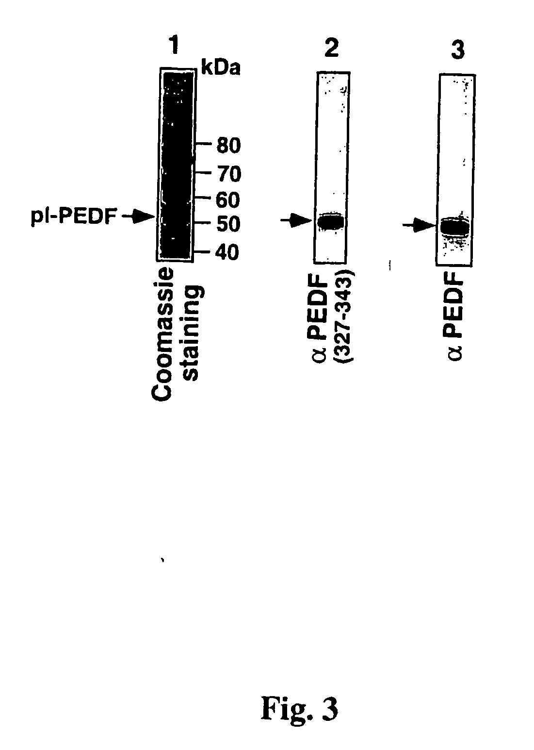 Pigment epithelium derived factor from human plasma and methods of use thereof