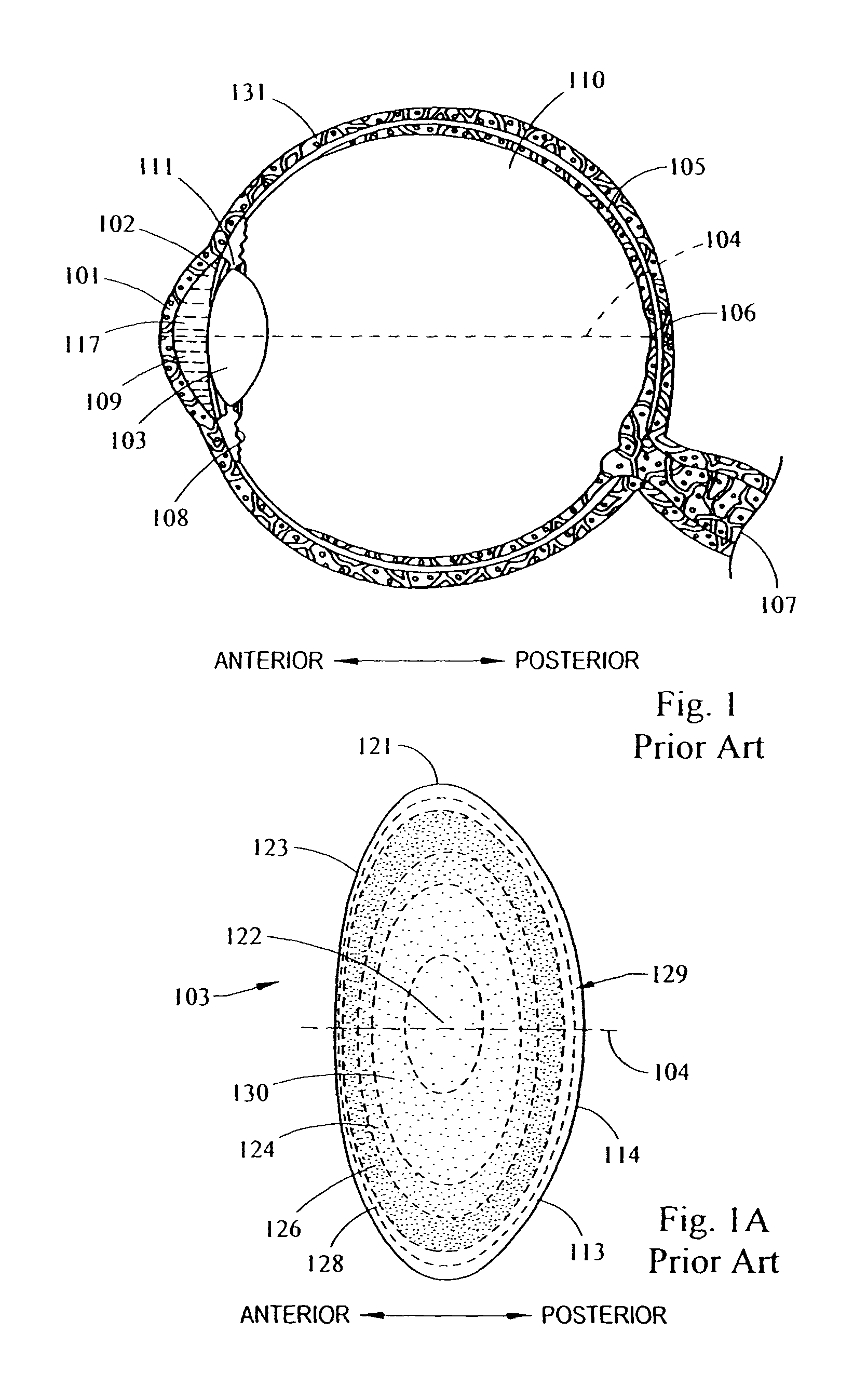 System and method for improving the accommodative amplitude and increasing the refractive power of the human lens with a laser
