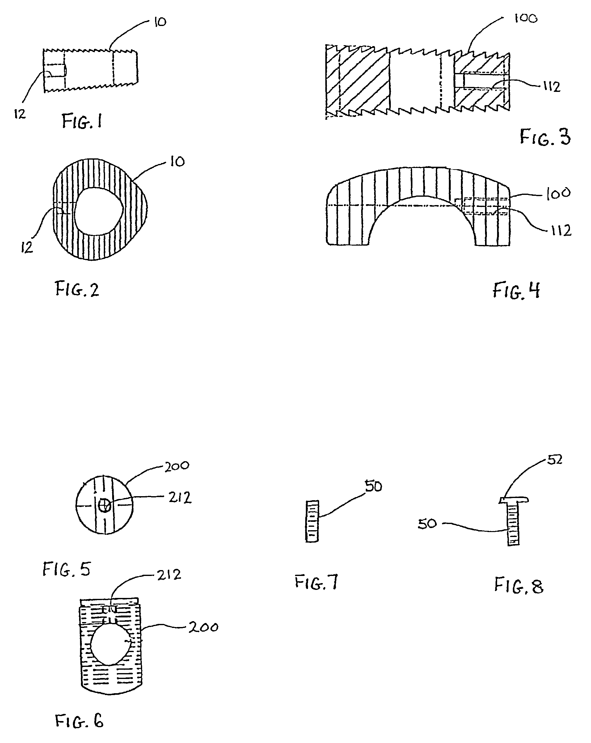 Osteoimplant and method for making same