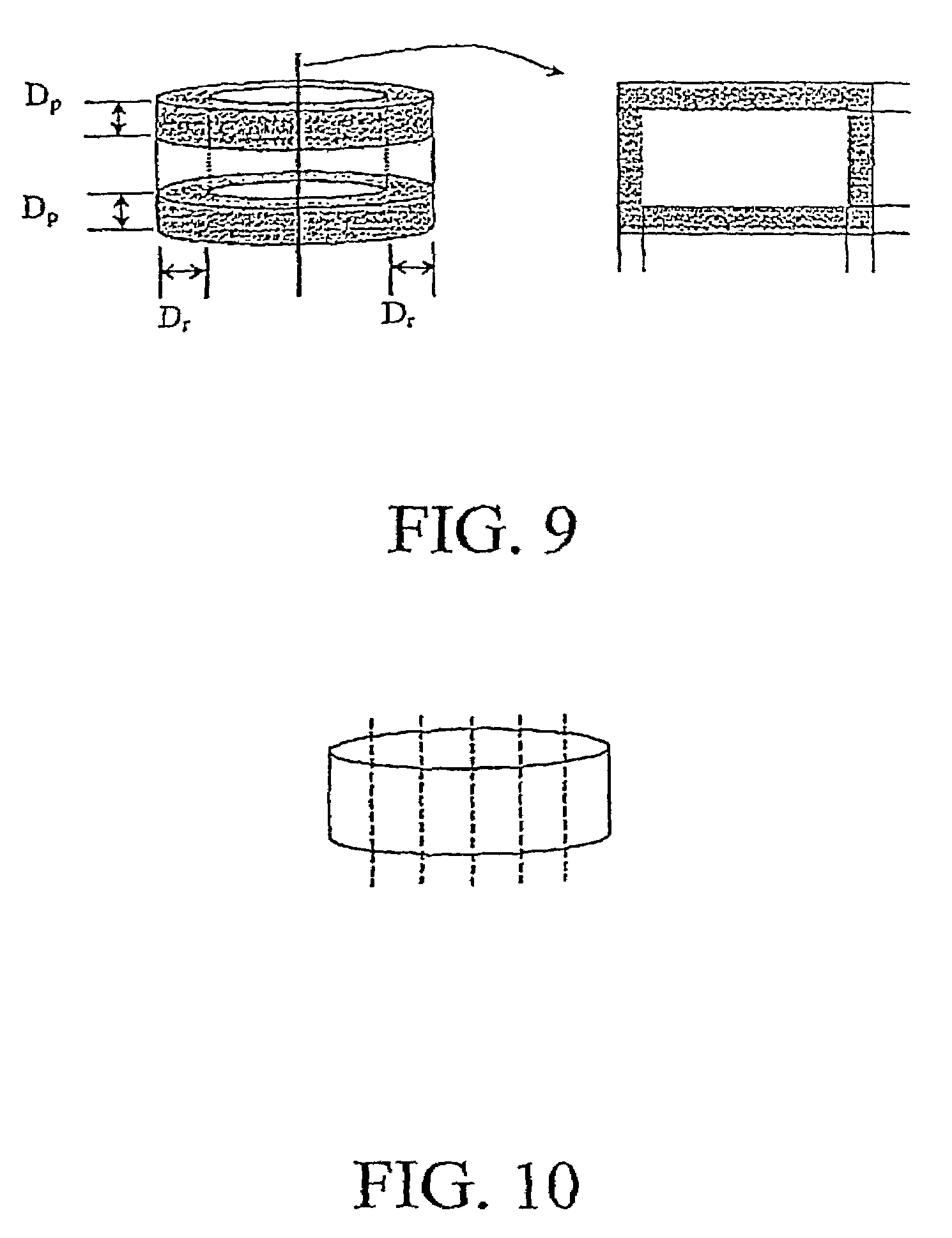 Osteoimplant and method for making same