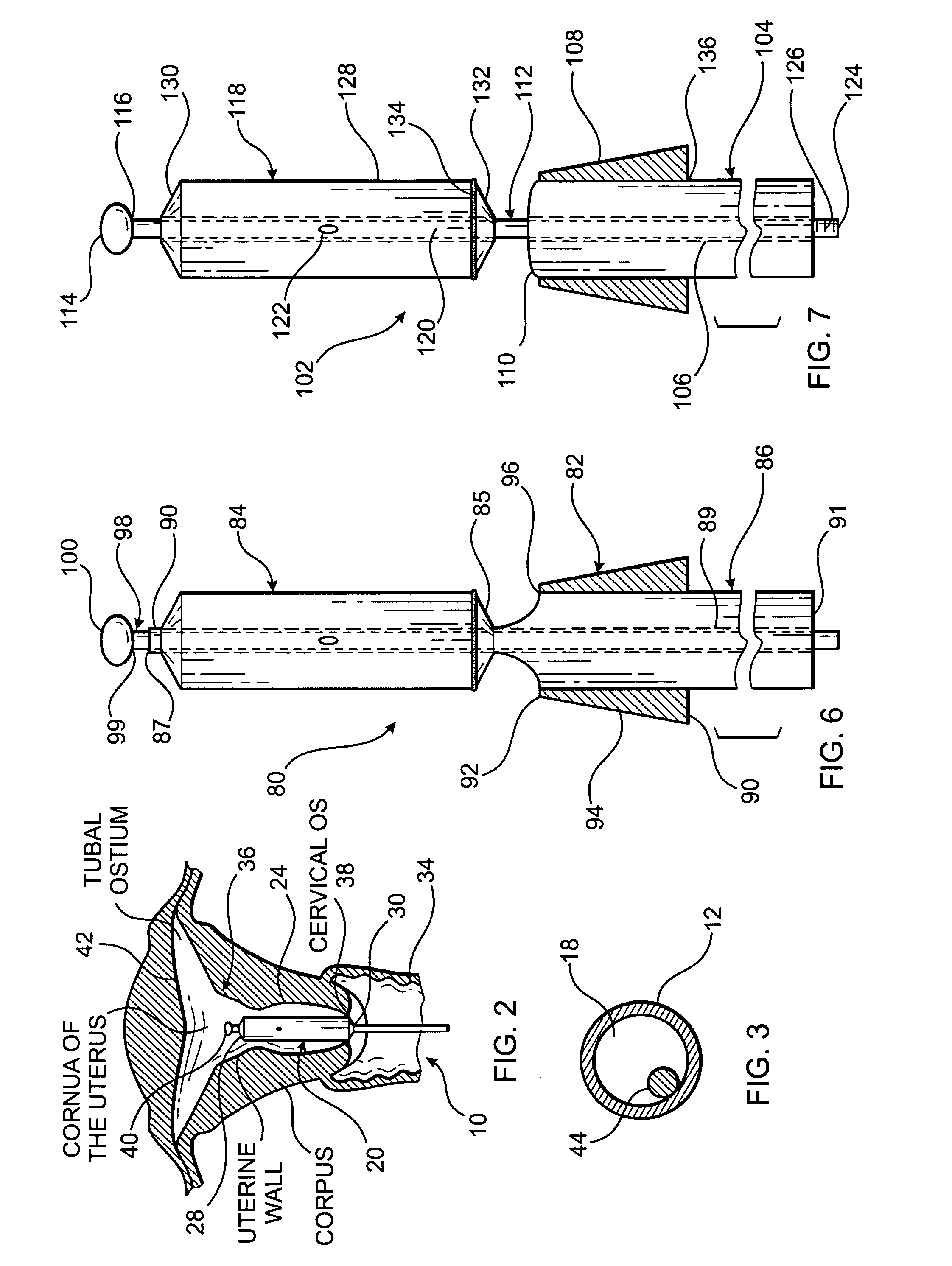 Cervical dilator and methods of use