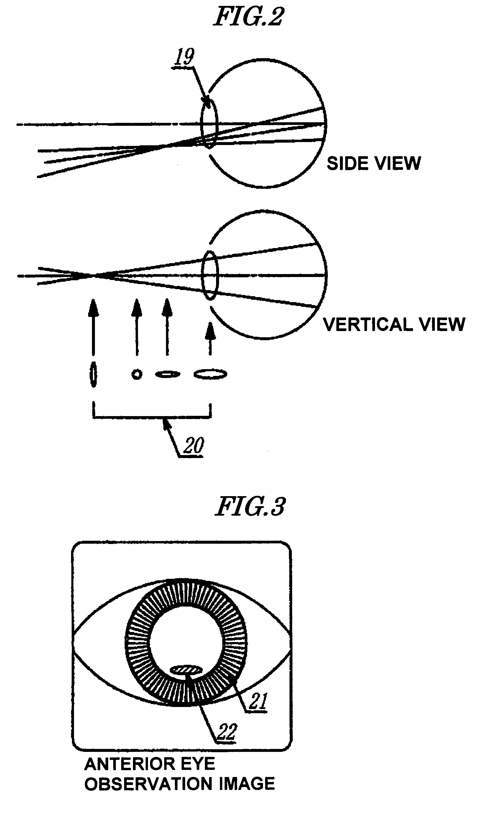 Wide viewing angle ocular fundus blood flow imaging device