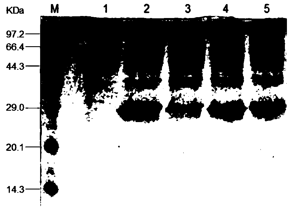 Trichoderma reesei engineering bacterium as well as preparation method and application thereof
