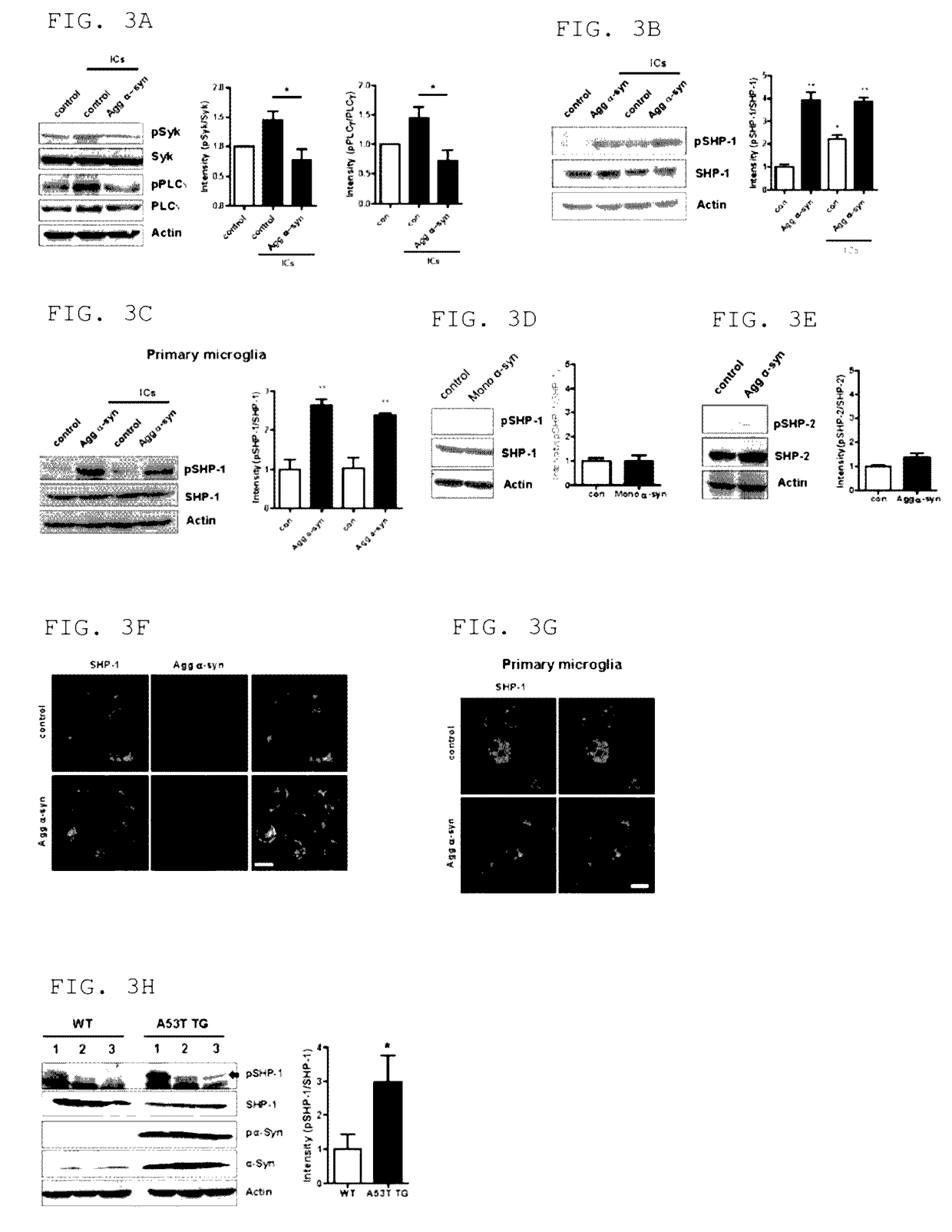 Pharmaceutical composition for preventing or treating neurodegenerative diseases