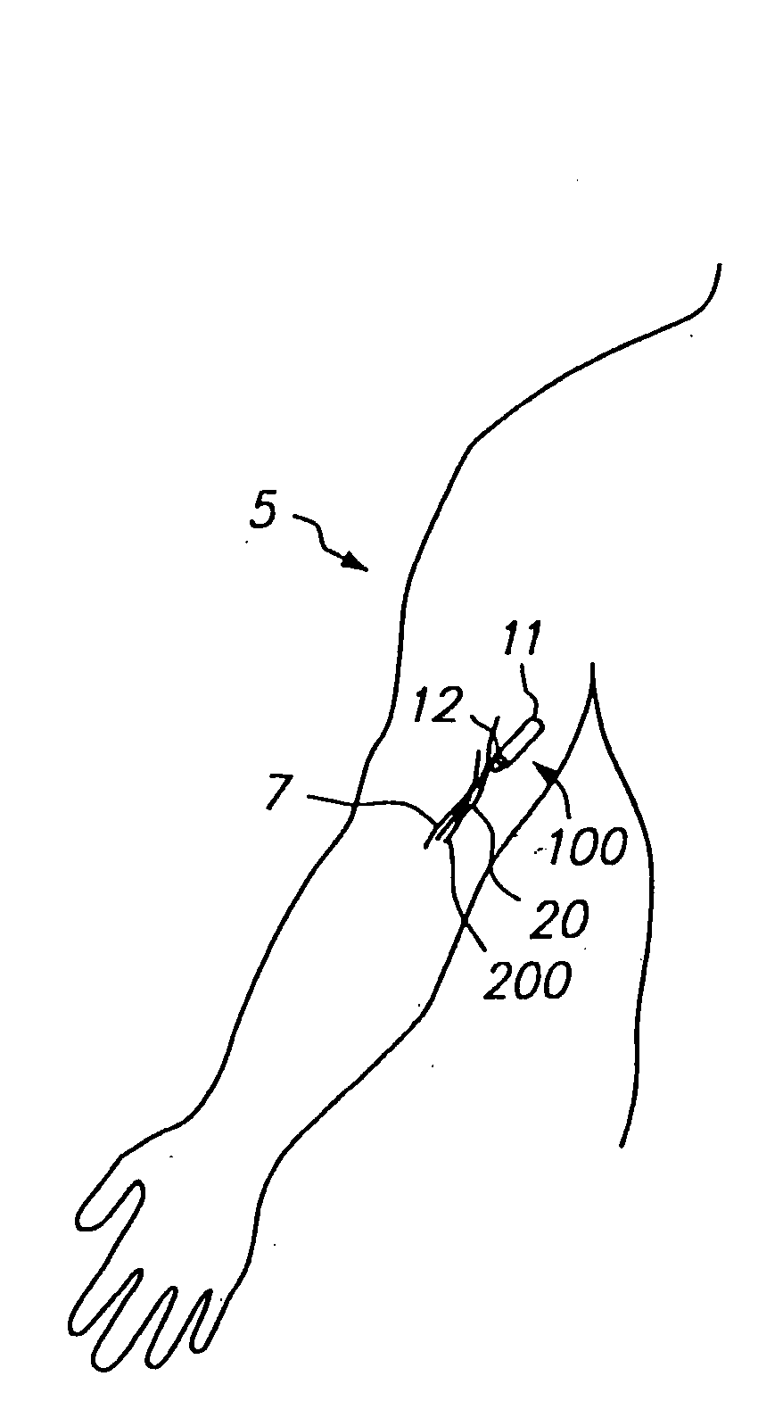 Devices and methods for pain management