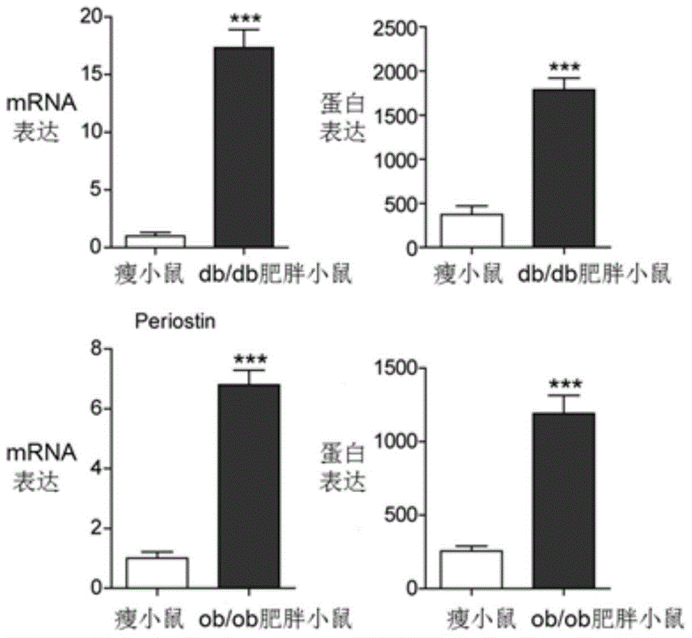 Applications of Periostin gene and Periostin antibody in preparation of medicaments