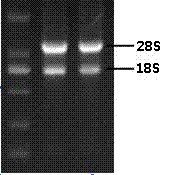 Construction method and application of complementary deoxyribonucleic acid (cDNA) of somatic embryogenesis receptor-like kinase (SERK) coding gene for regulating somatic embryogenesis of anthurium andraeanum