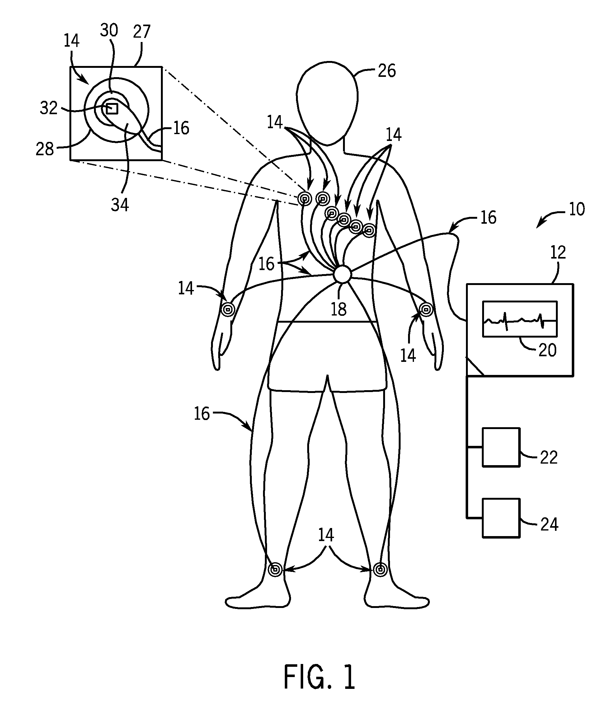 System and method of performing electrocardiography with motion detection
