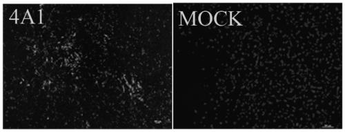 Hybridoma cell strain to secrete anti-Rabies virus M protein monoclonal antibody and application thereof
