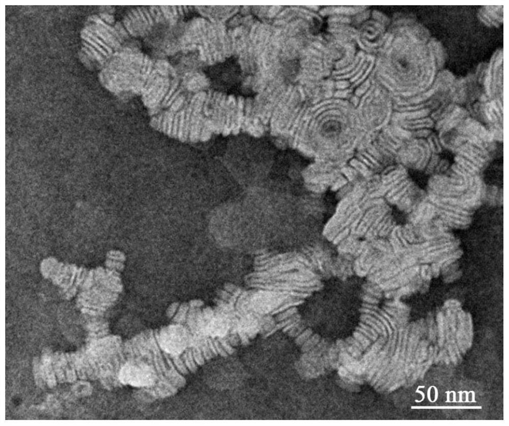 Chitosan lipoprotein nasal delivery nanocomposite as well as preparation method and application thereof