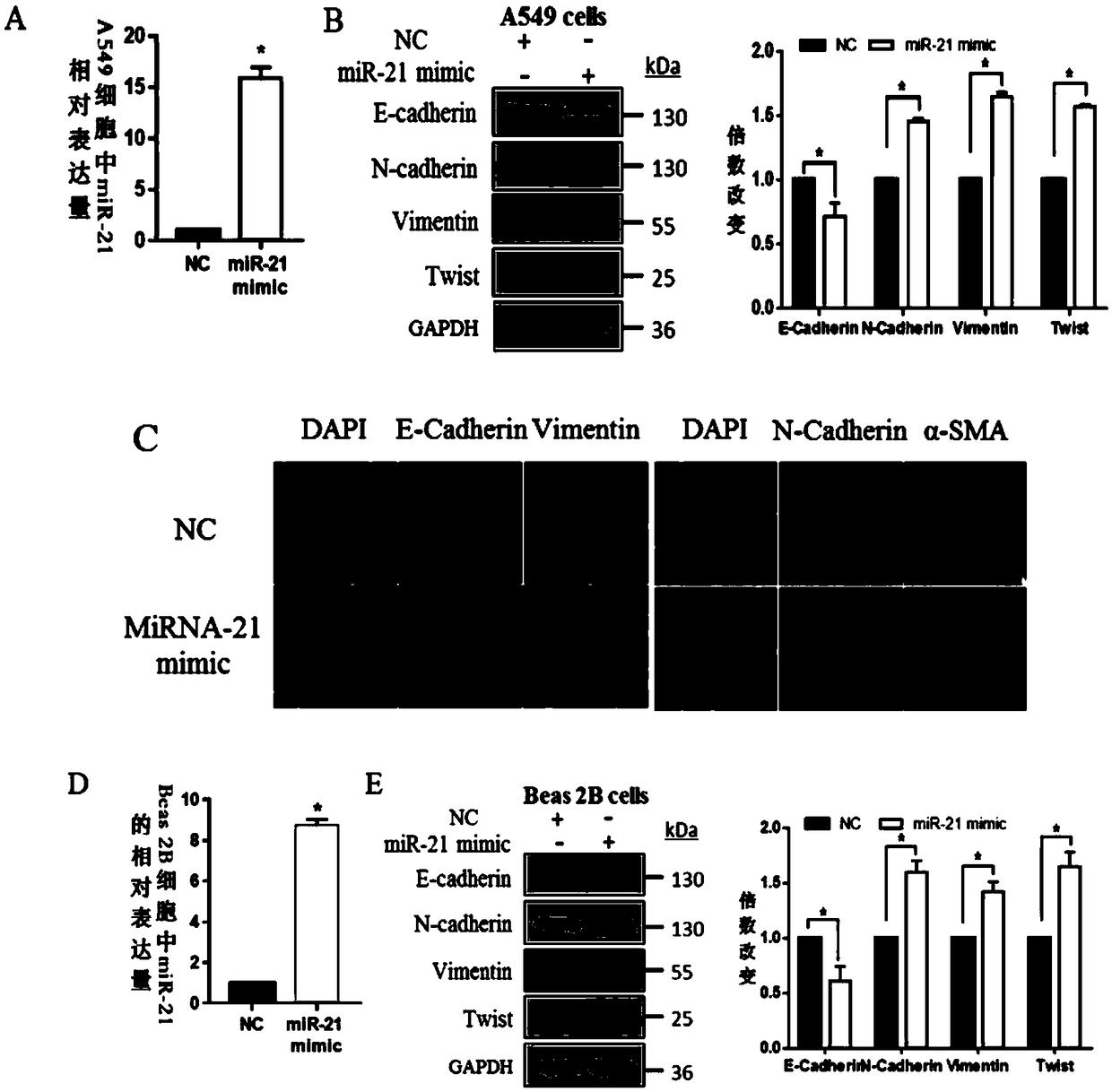 Application of miR-21 in regulation of ionizing radiation induced epithelial-mesenchymal transition