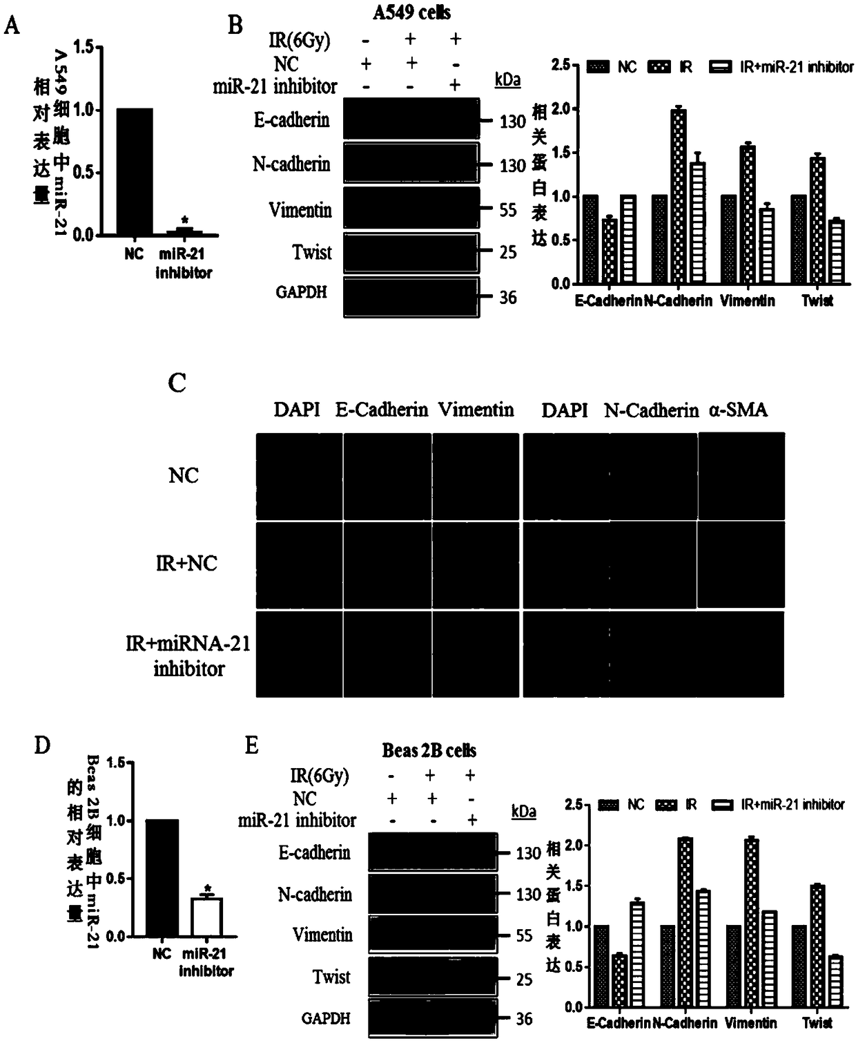 Application of miR-21 in regulation of ionizing radiation induced epithelial-mesenchymal transition