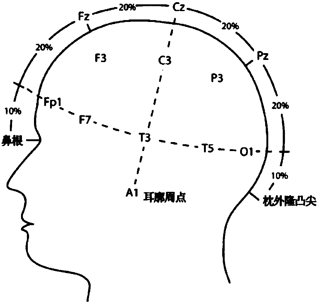 Device and method for positioning eeg or meg electrodes in brain mr images