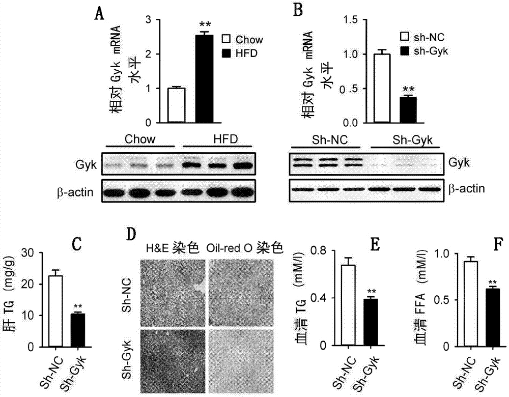 Use of glycerol kinase in preparation of drug for regulating lipid metabolism