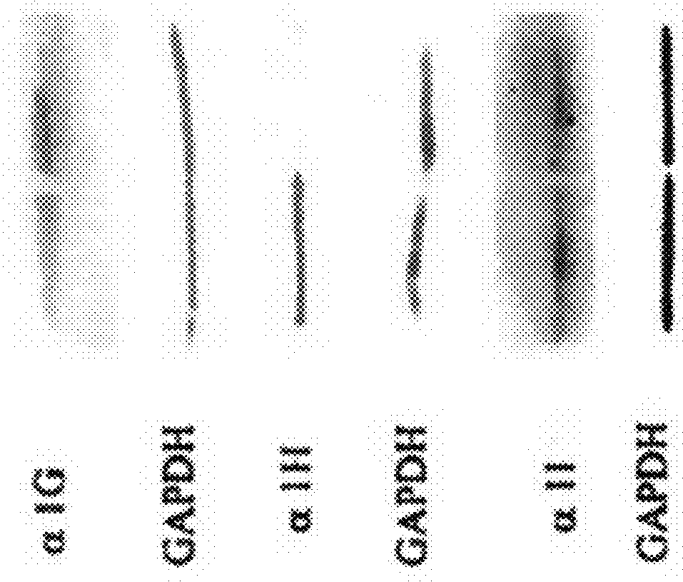 Methods for modulating klhl1 levels, methods for modulating current activity in t-type calcium channels, molecules therefor, and methods for identifying molecules therefor