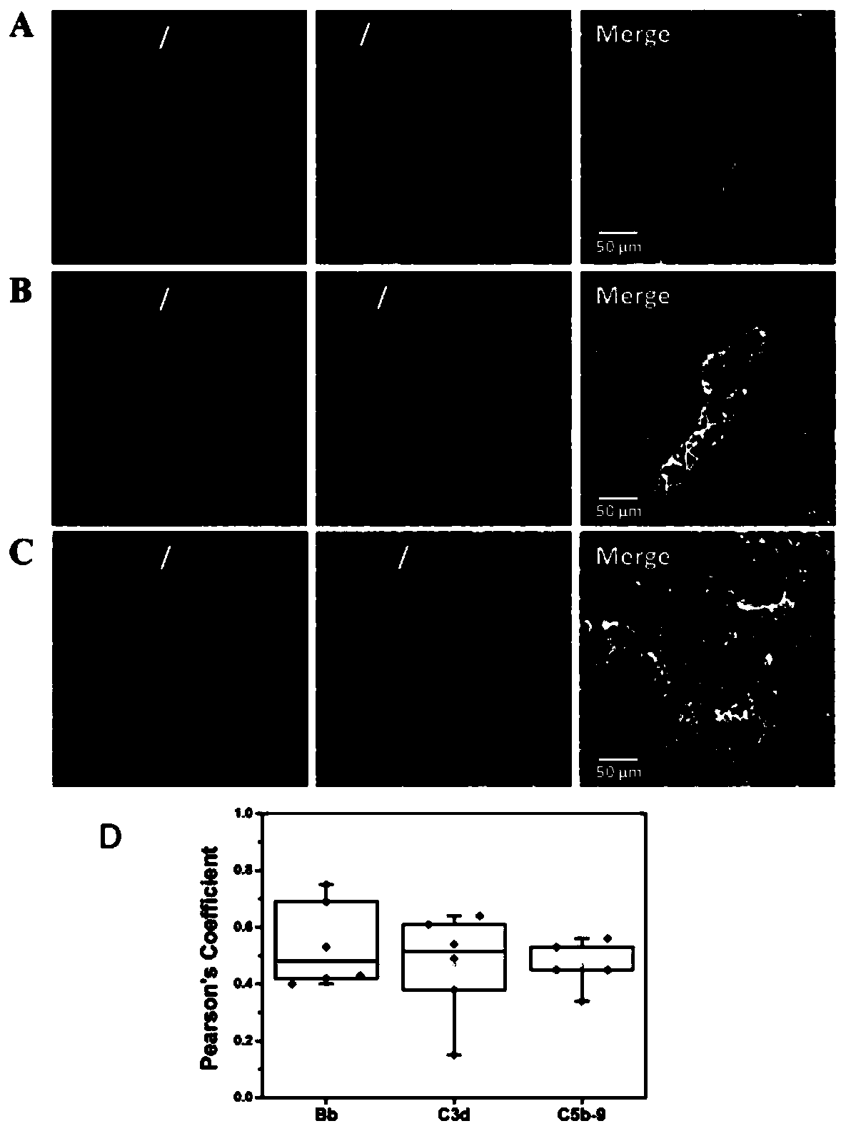 Molecular marker for diagnosing lupus nephritis concurrent pulmonary arterial hypertension disease and application thereof