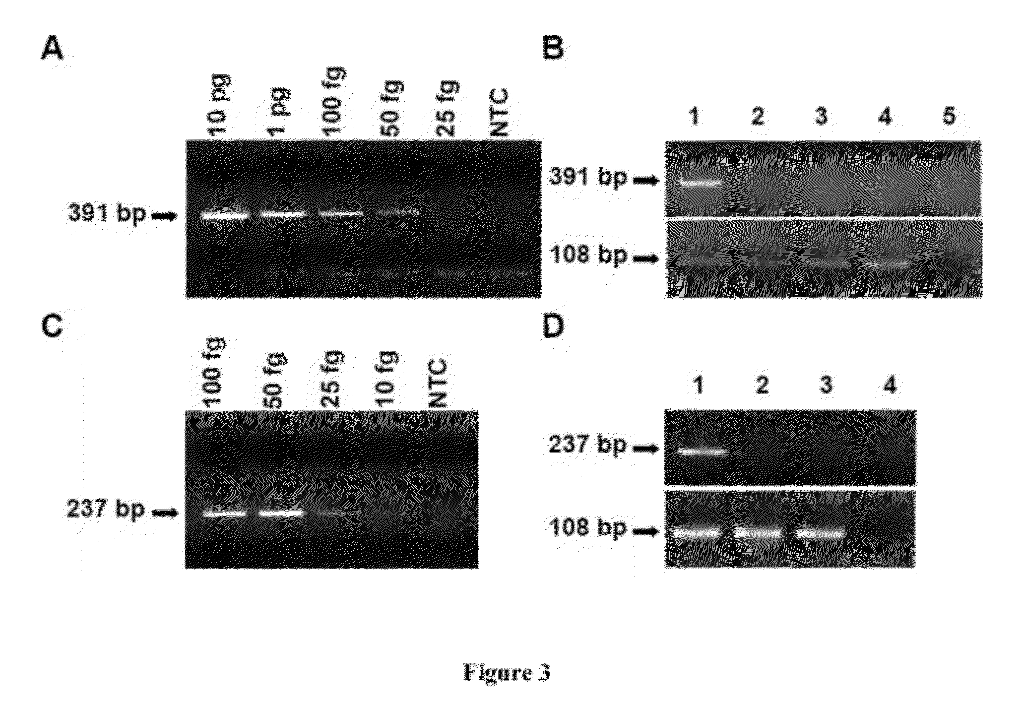 Methods, systems, and compositions for detection of microbial DNA by PCR