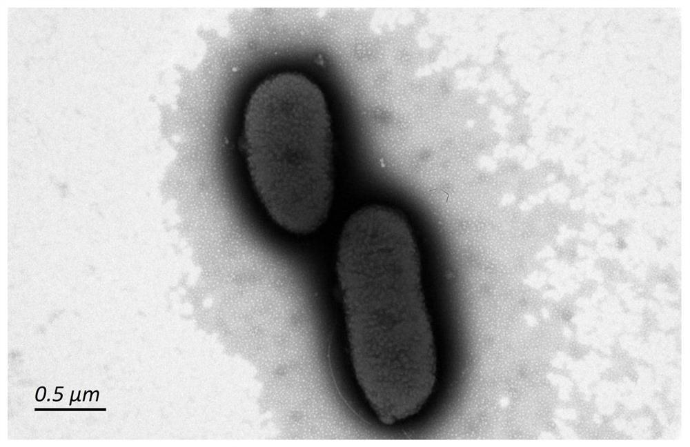 Quantitative detection method of rabies virus inactivated antigen