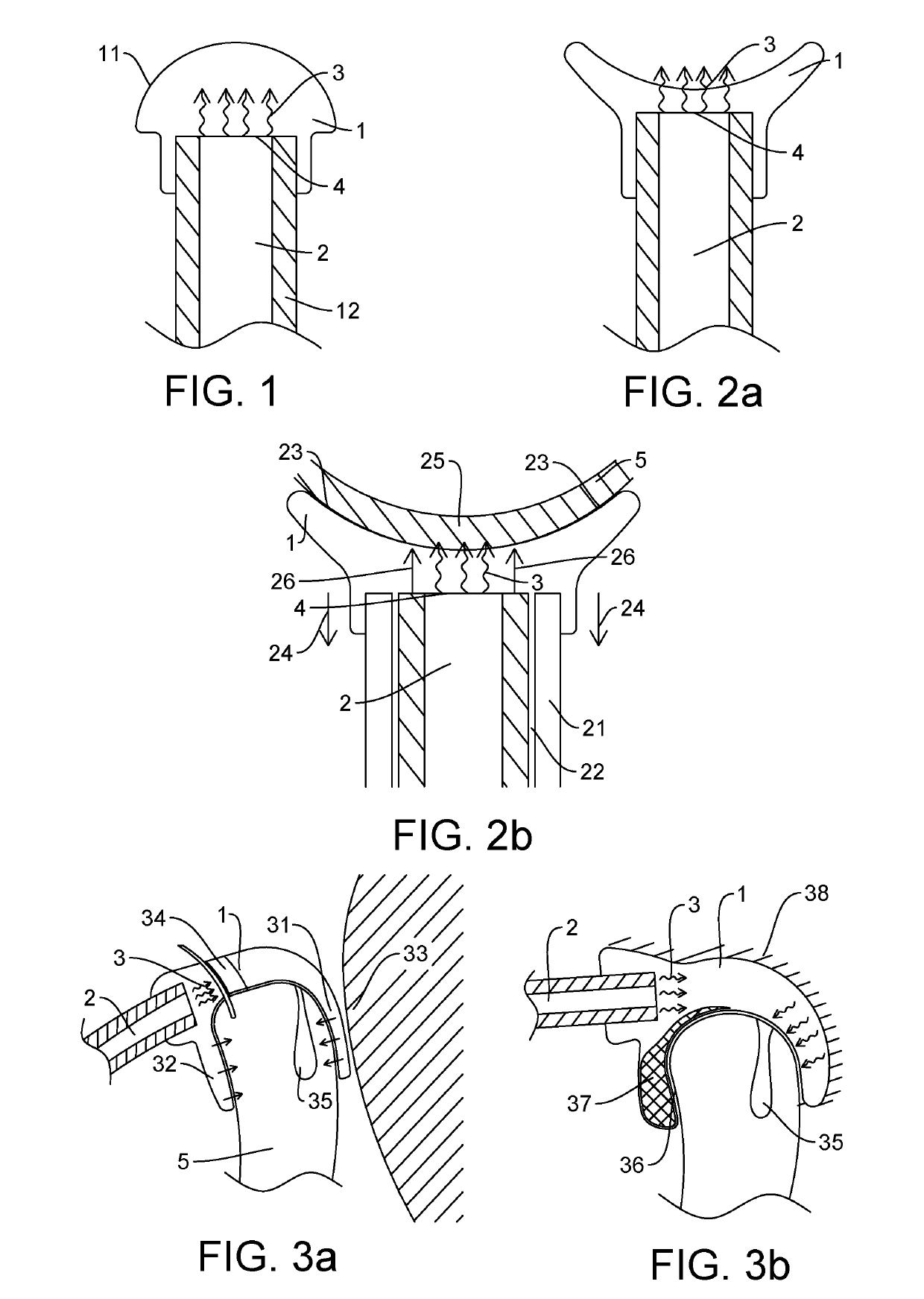 Apparatus and method for treatment of dry eyes