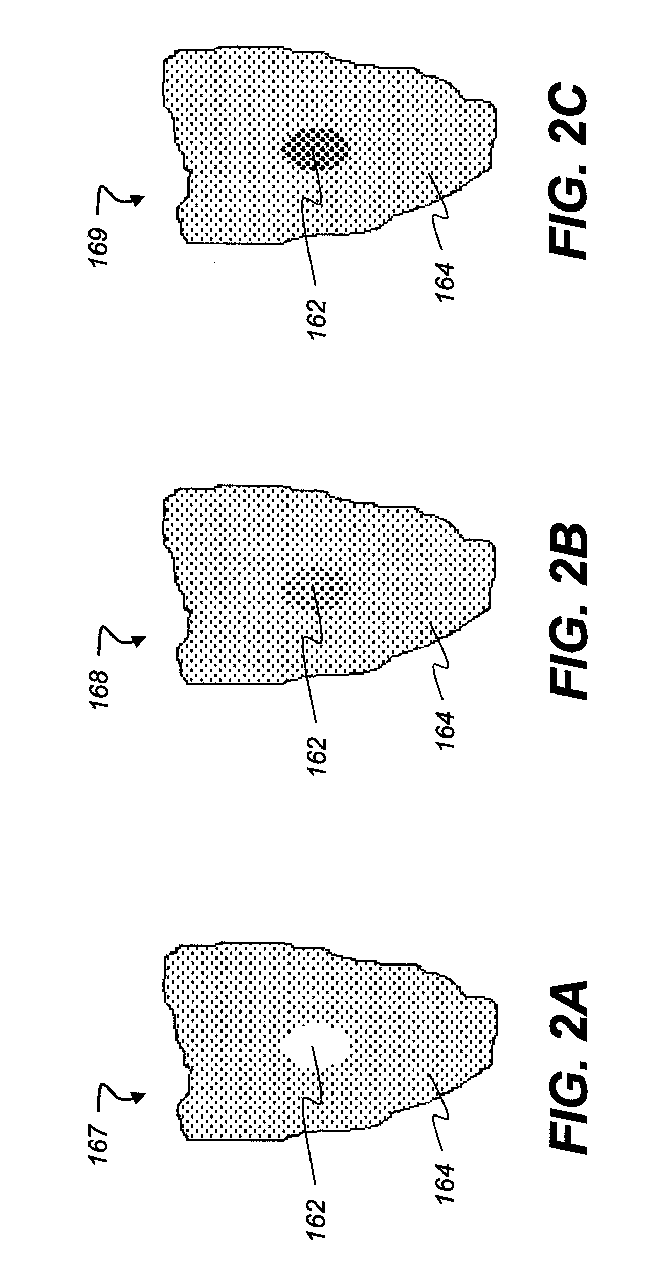 Method for locating an interproximal tooth region