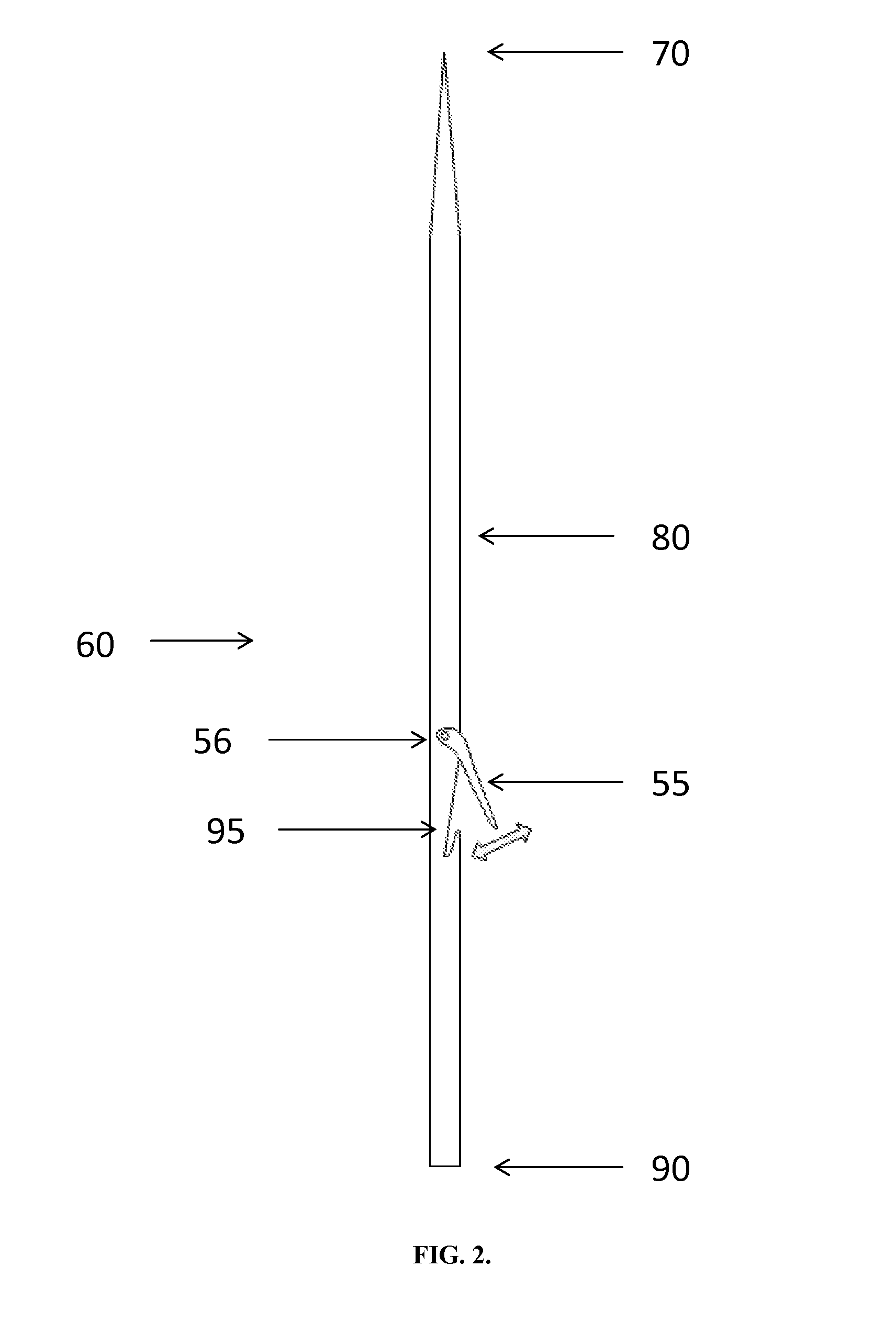 Locking needle for inflatable penile prosthesis