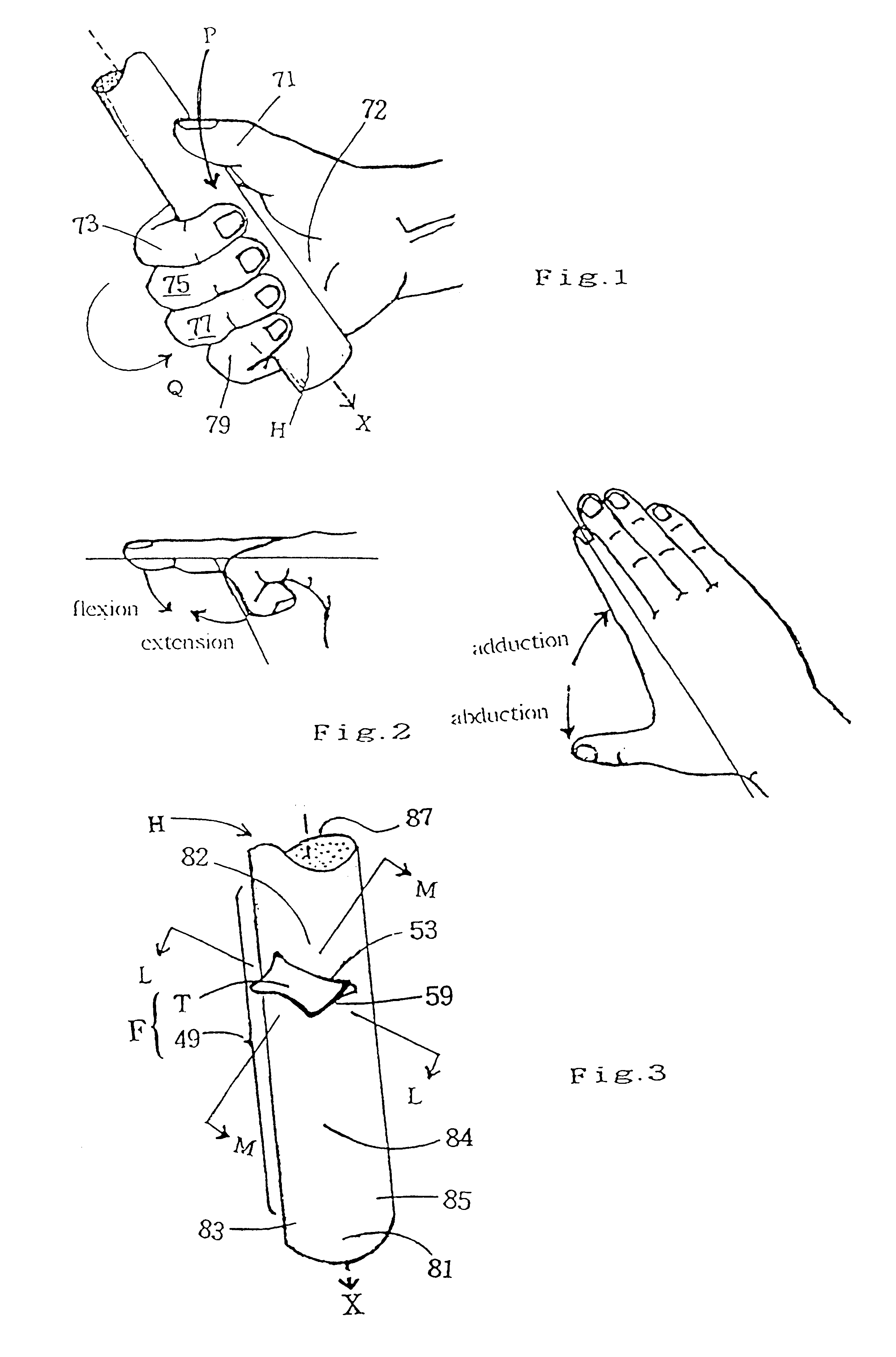 Finger supporting structure