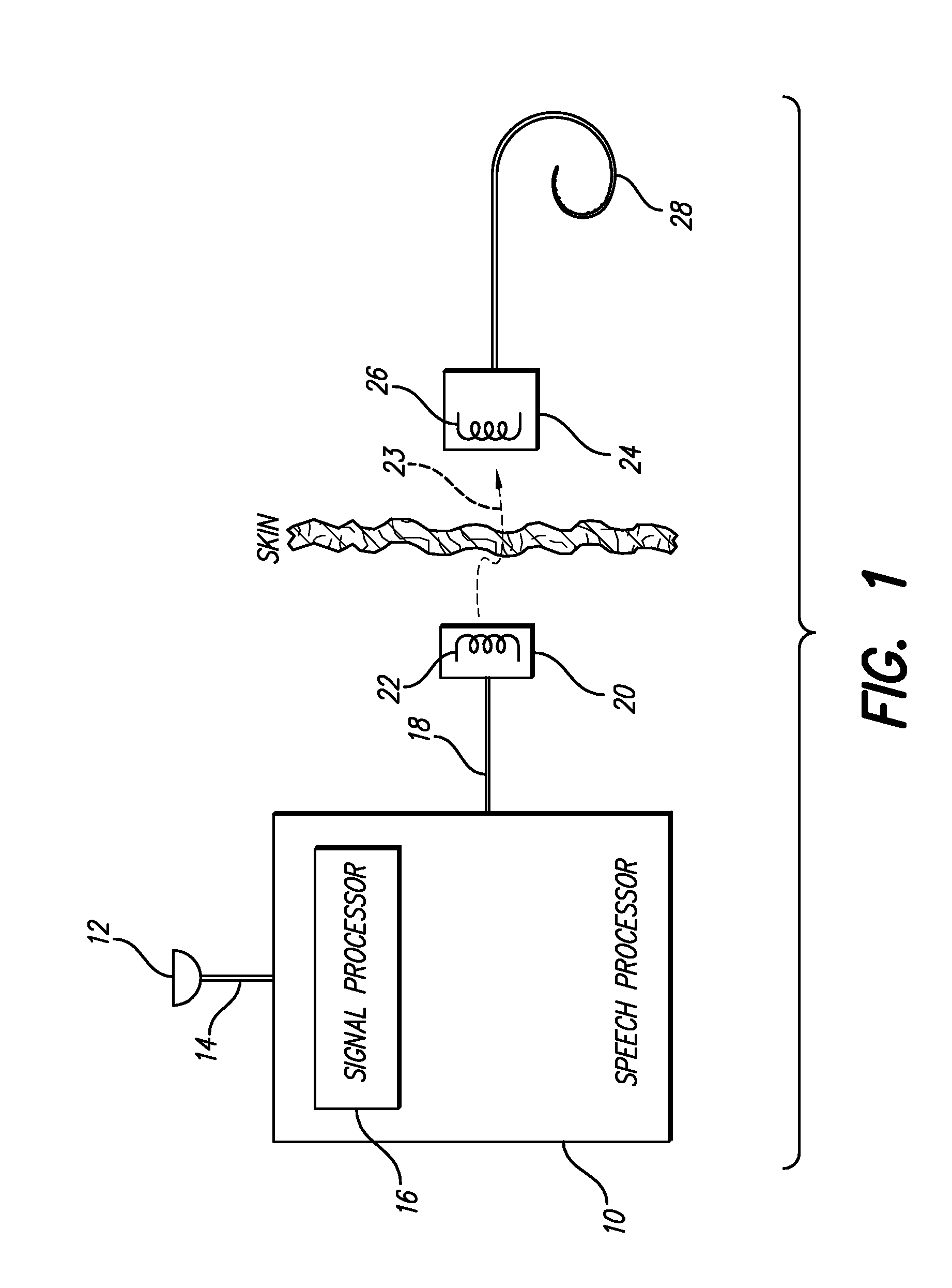 Distributed compression amplitude mapping for a cochlear stimulation system