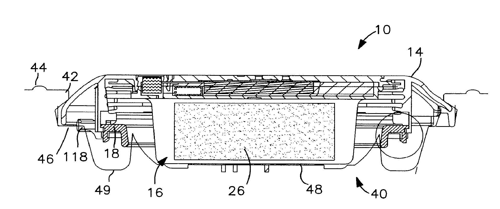 Controlled discharge ostomy appliance and shield therefor