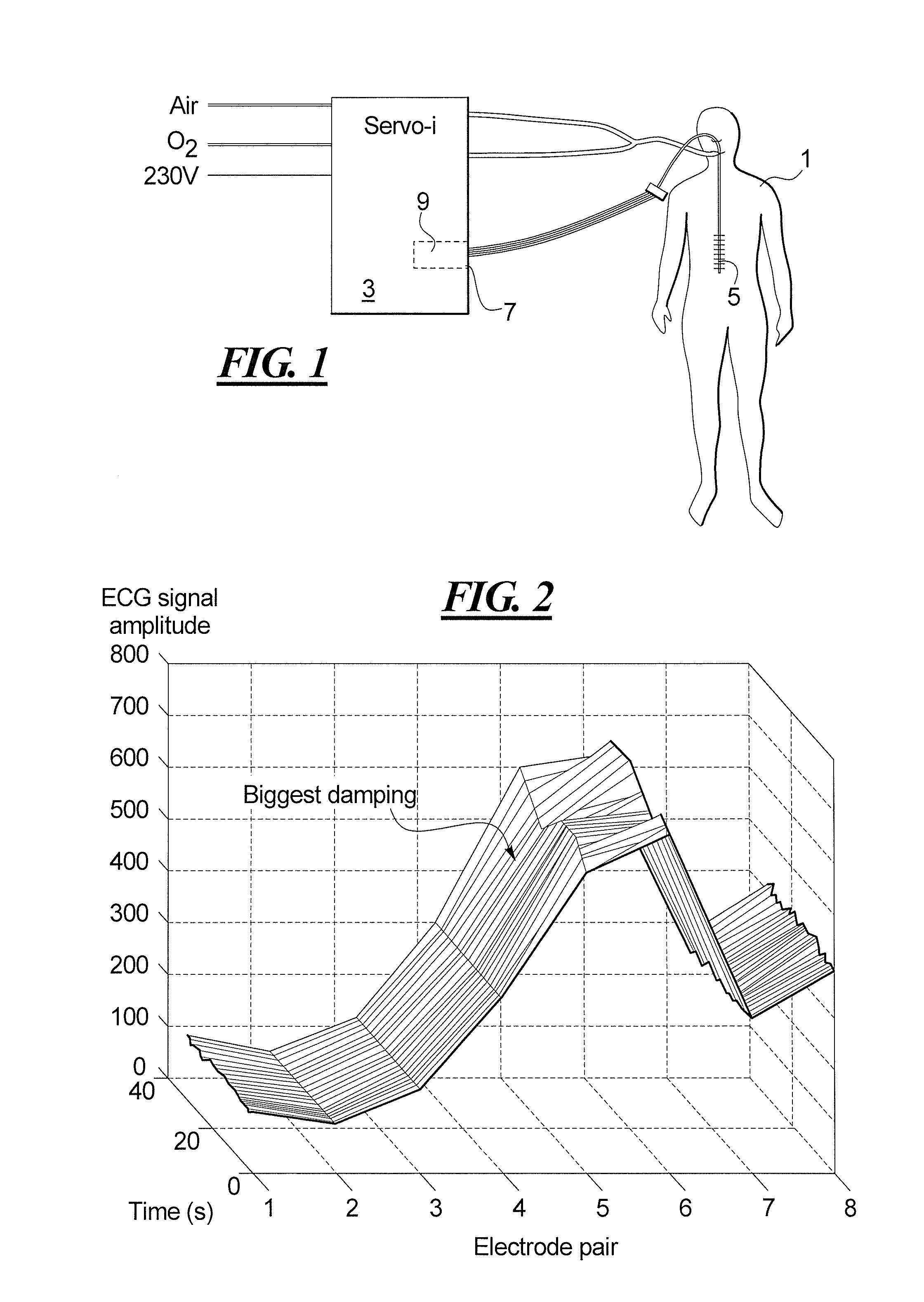 Catheter positioning method and computerized control unit for implementing the method