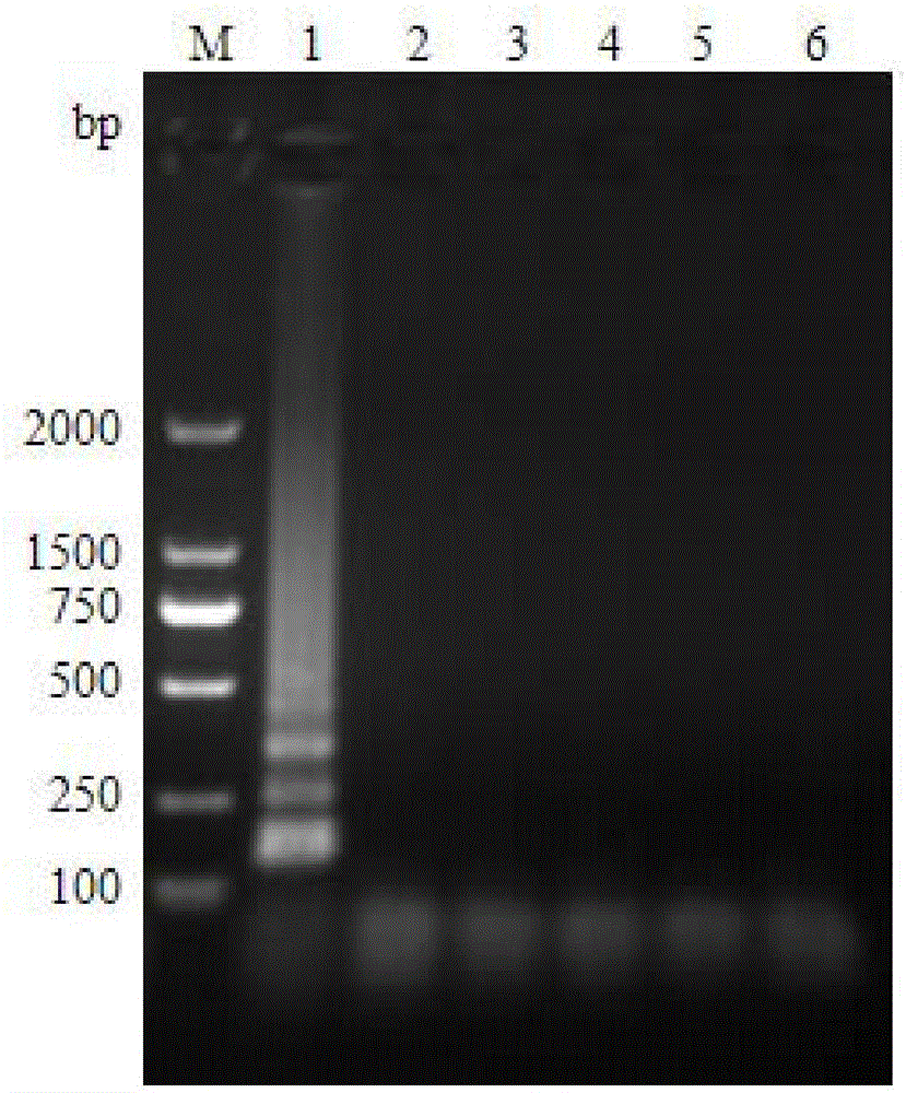 LAMP detection kit for Enterocytozoon hepatopenaei