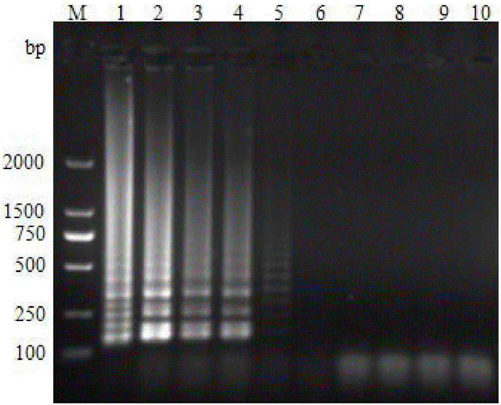 LAMP detection kit for Enterocytozoon hepatopenaei