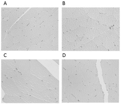 A kind of tediroxin suspension injection and preparation method thereof