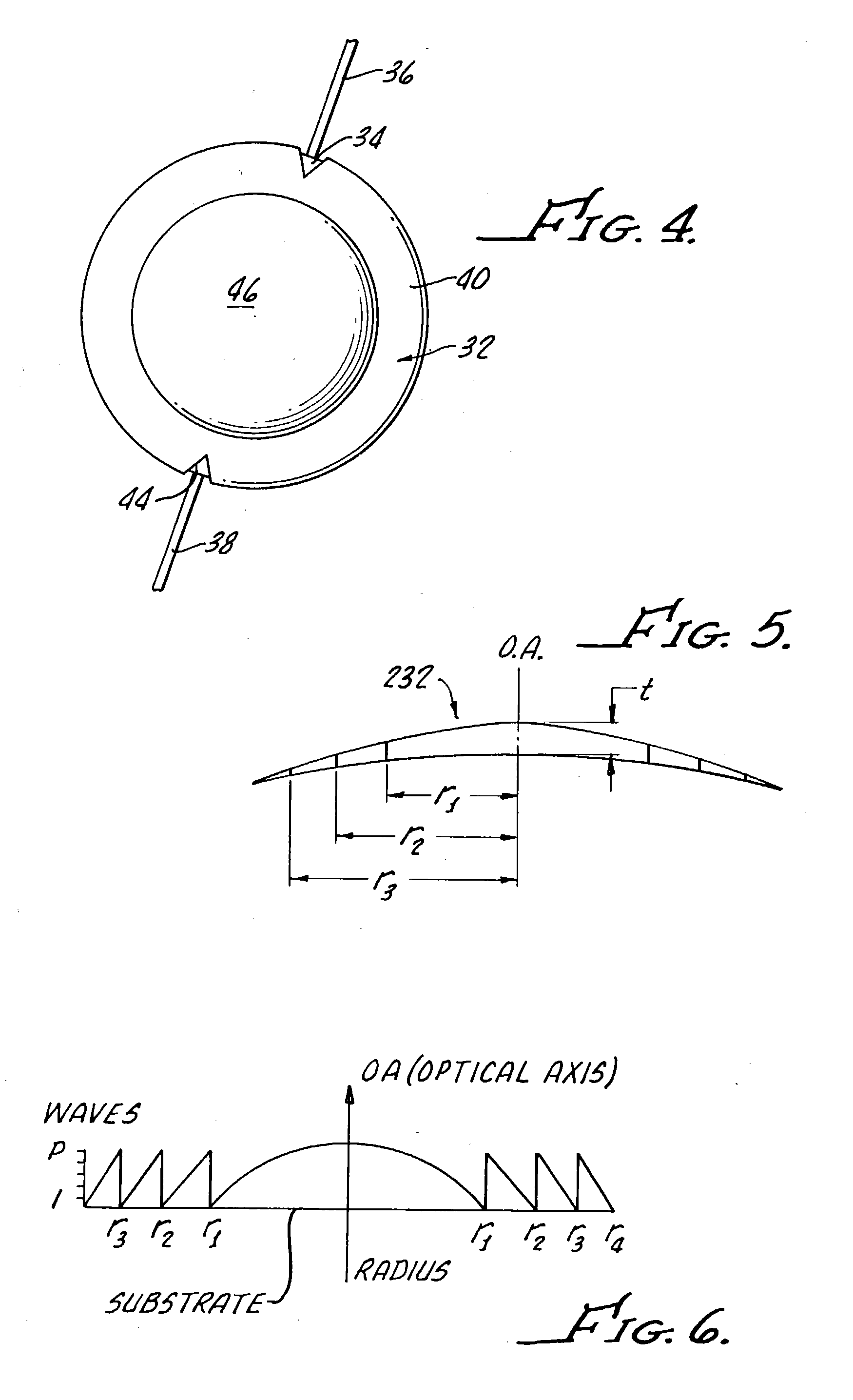 Primary and supplemental intraocular lens