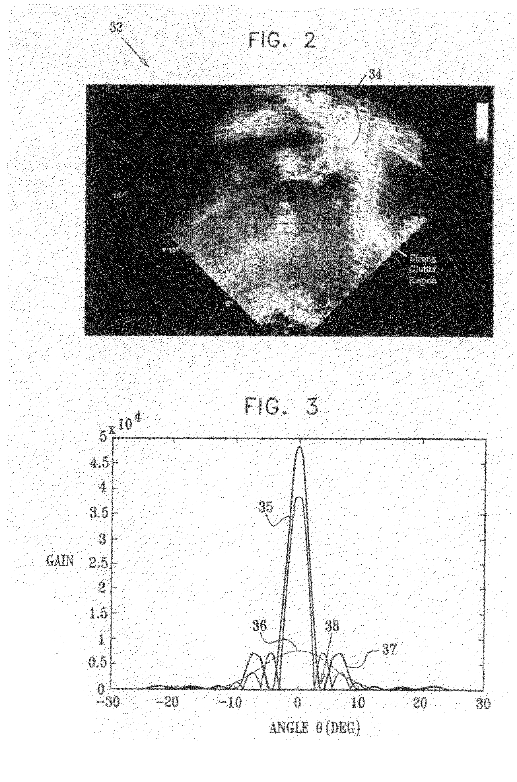 Clutter suppression in ultrasonic imaging systems