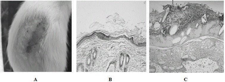 Traditional Chinese medicine composition used for controlling radiothermitis and application thereof