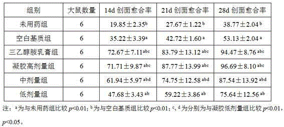 Traditional Chinese medicine composition used for controlling radiothermitis and application thereof