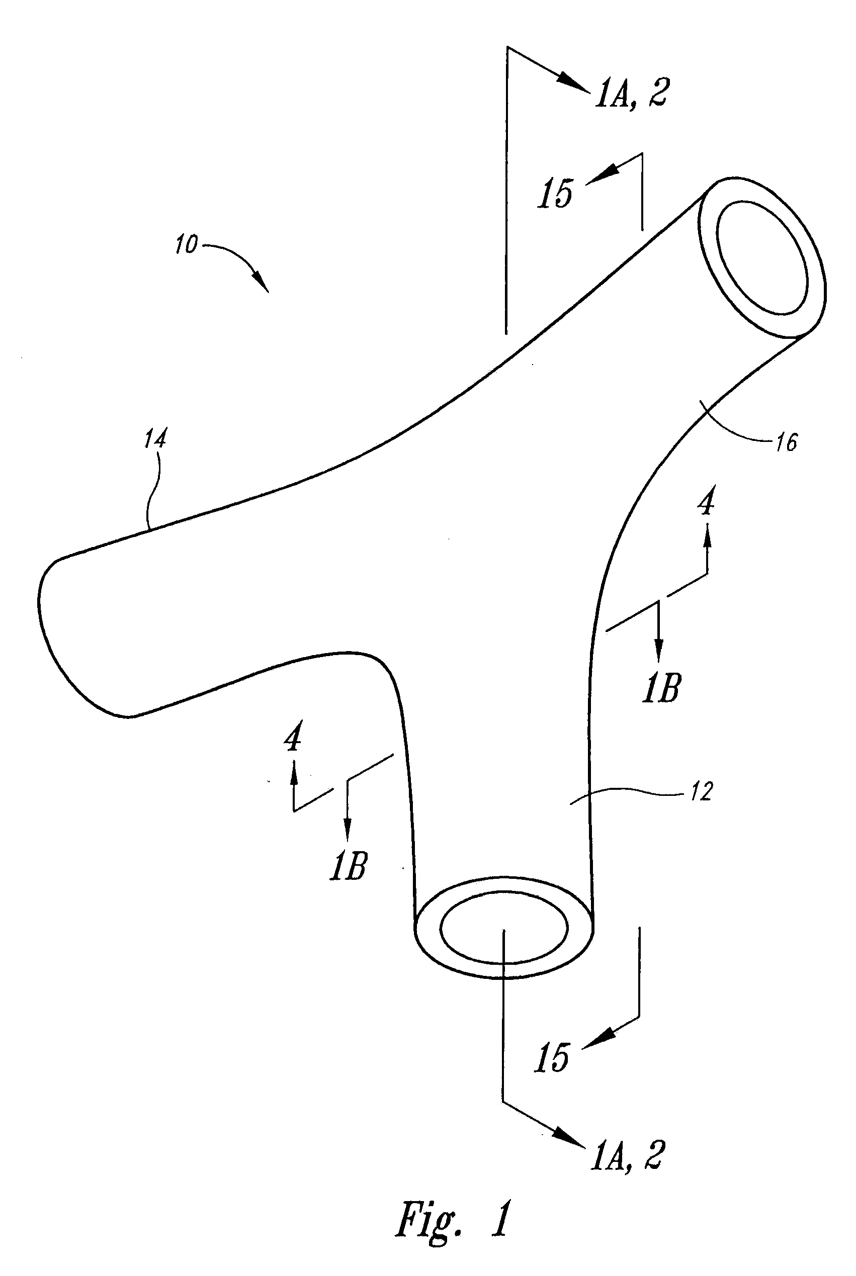 Vascular anchoring system and method