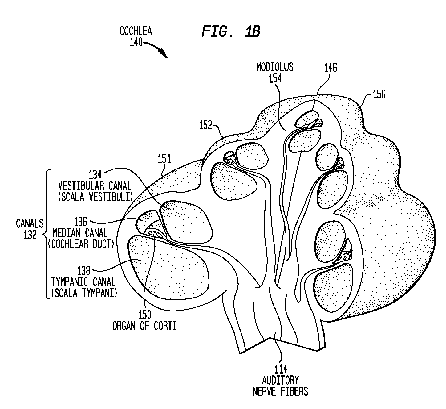 Direct acoustic cochlear stimulator for round window access