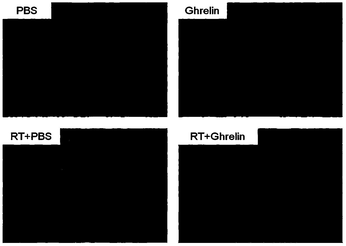 Application of ghrelin in prevention or/and treatment of radiation-induced lung injury