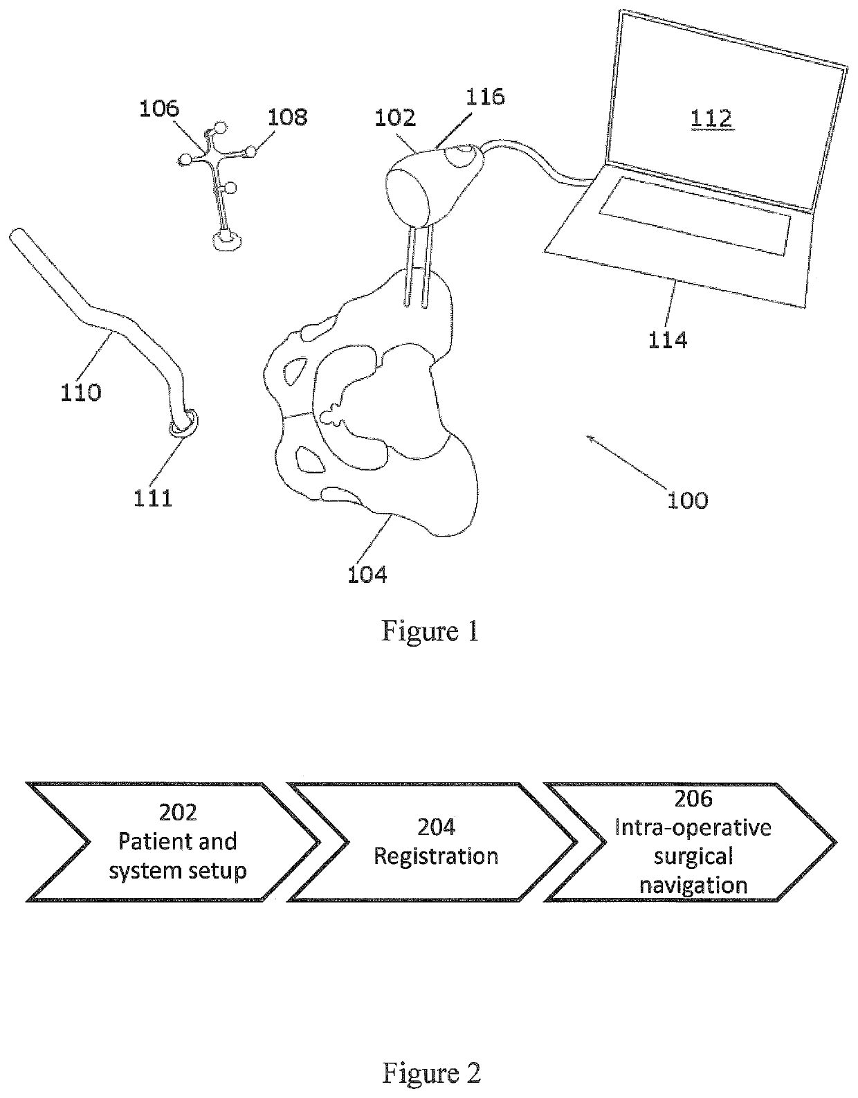 Systems, methods and devices for calculating hip center of rotation, adjusting parameters of joint replacement for pelvic tilt and calculating leg length and offset